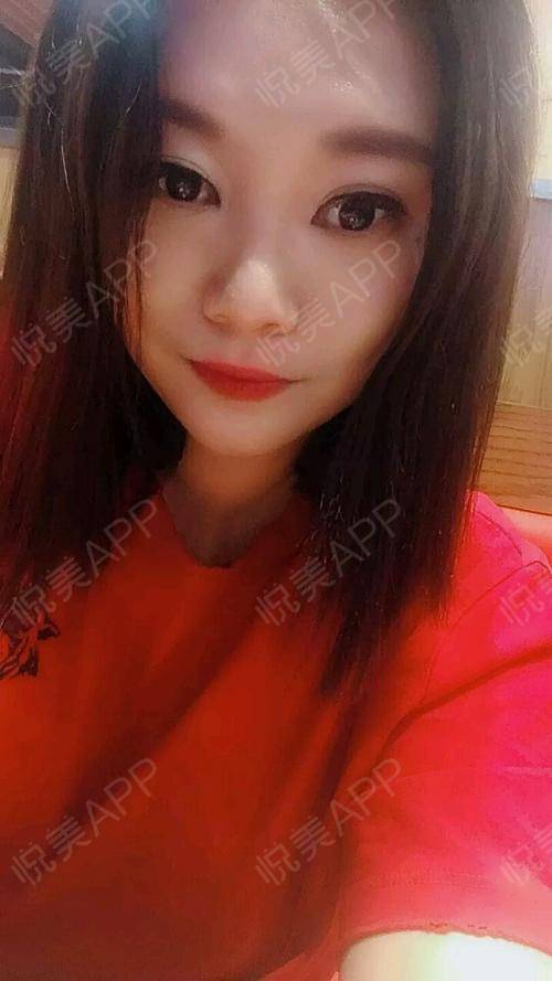 私密漂红术后30天_女性私密术后30天_私密整形术后30天_悦mer