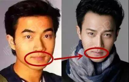 嘴唇应该也有改过  刘恺威以前的唇形很平没有弧度 而且有点外翻 修整