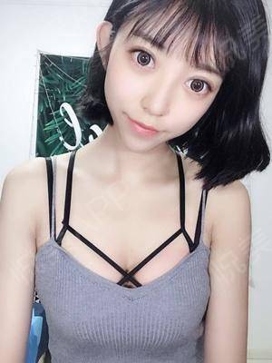 假体隆胸术后14天_隆胸术后14天_自体脂肪术后14天_胸部术后14天_清秋