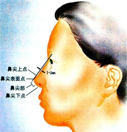 鼻背比鼻根点和鼻尖连线低1~2mm