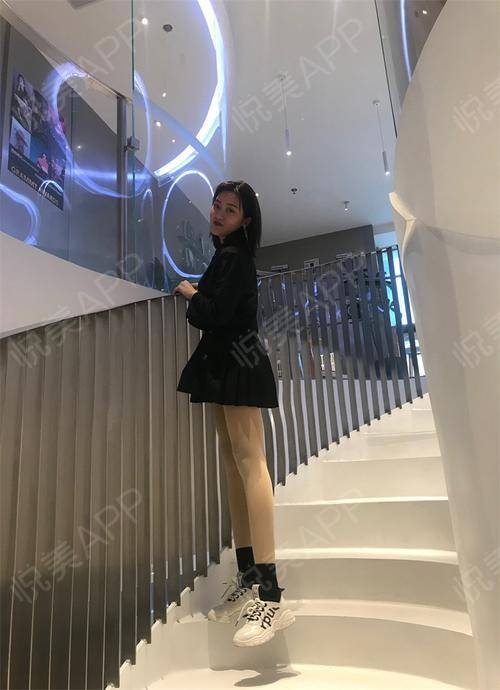 吸脂术后100天_瘦大腿术后100天_美体塑形术后100天_王馨馨分享图片7